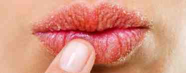 Почему сохнут губы и как их сделать нежными, влажными и манящими