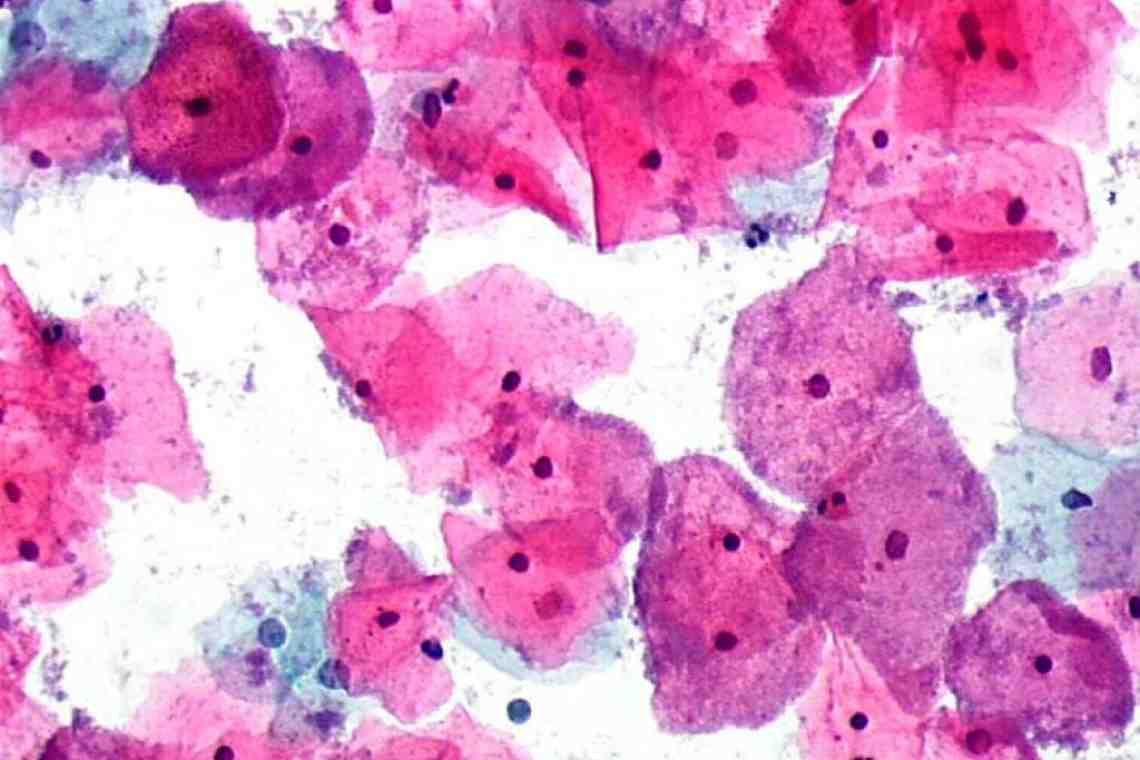 сперма микрофлора влагалища фото 49