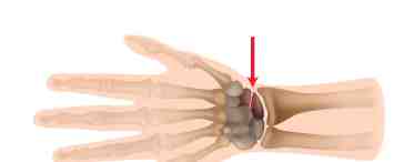 Кости руки: названия и функции. Что делать, если болят кости руки