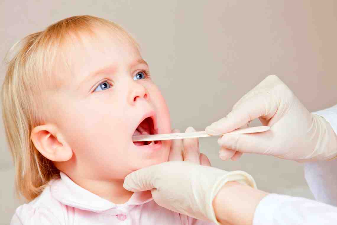 Как лечить стрептококк у ребенка