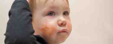 Может ли быть аллергия на тыкву у ребенка