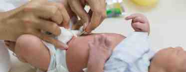 Как правильно обрабатывать пупочную рану новорожденного?