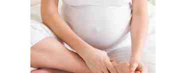 Как избавиться от отеков беременной
