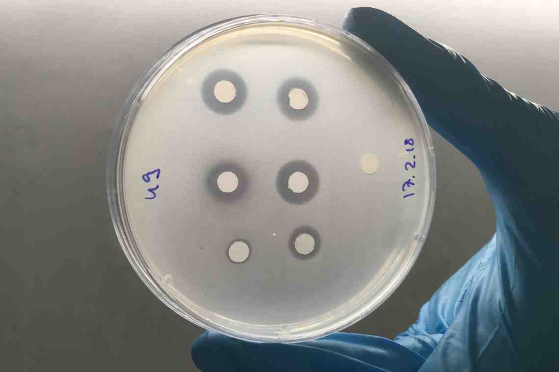 Ученые обнаружили сопротивляемость к антибиотикам