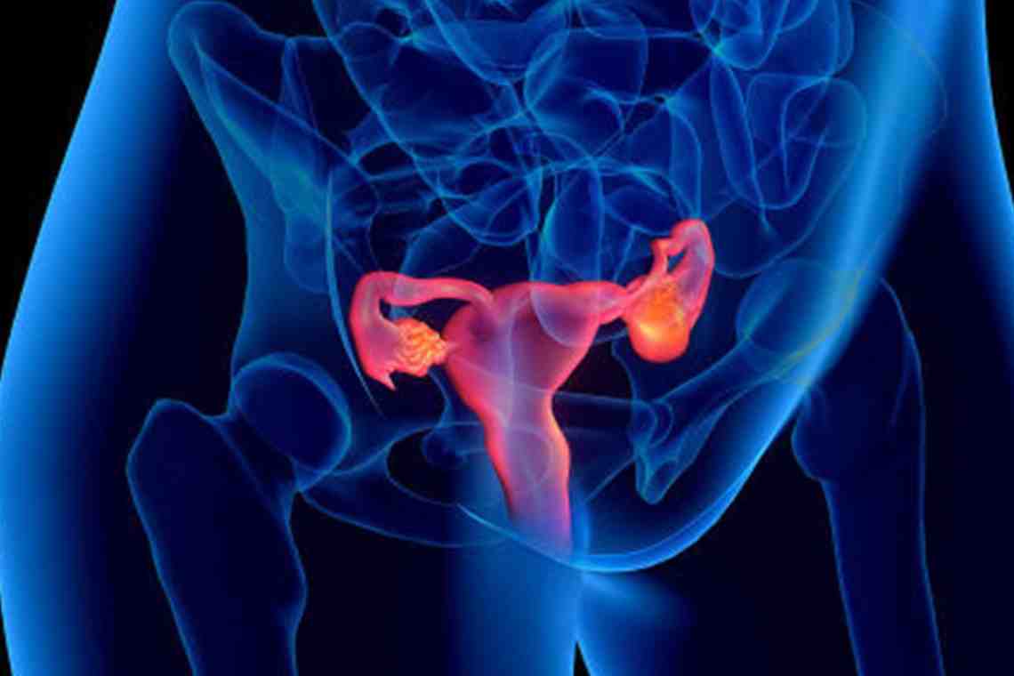 Воспаление матки: причины, лечение
