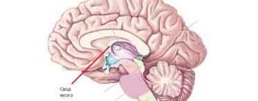 Мозолистое тело головного мозга: строение, функции