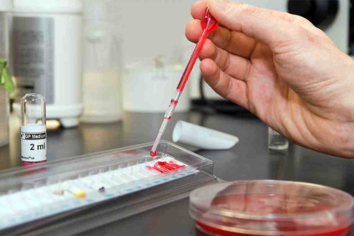 Серологические исследования крови в диагностике болезней