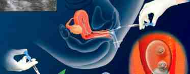 Имплантация эмбриона в матку. Что происходит после оплодотворения?