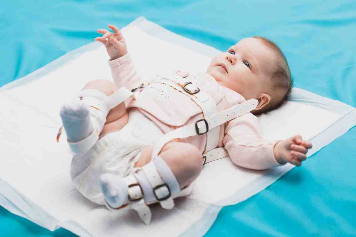 Дисплазия тазобедренного сустава у новорожденных. Что нужно знать о болезни?