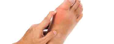 Как быть - болит большой палец на ноге?