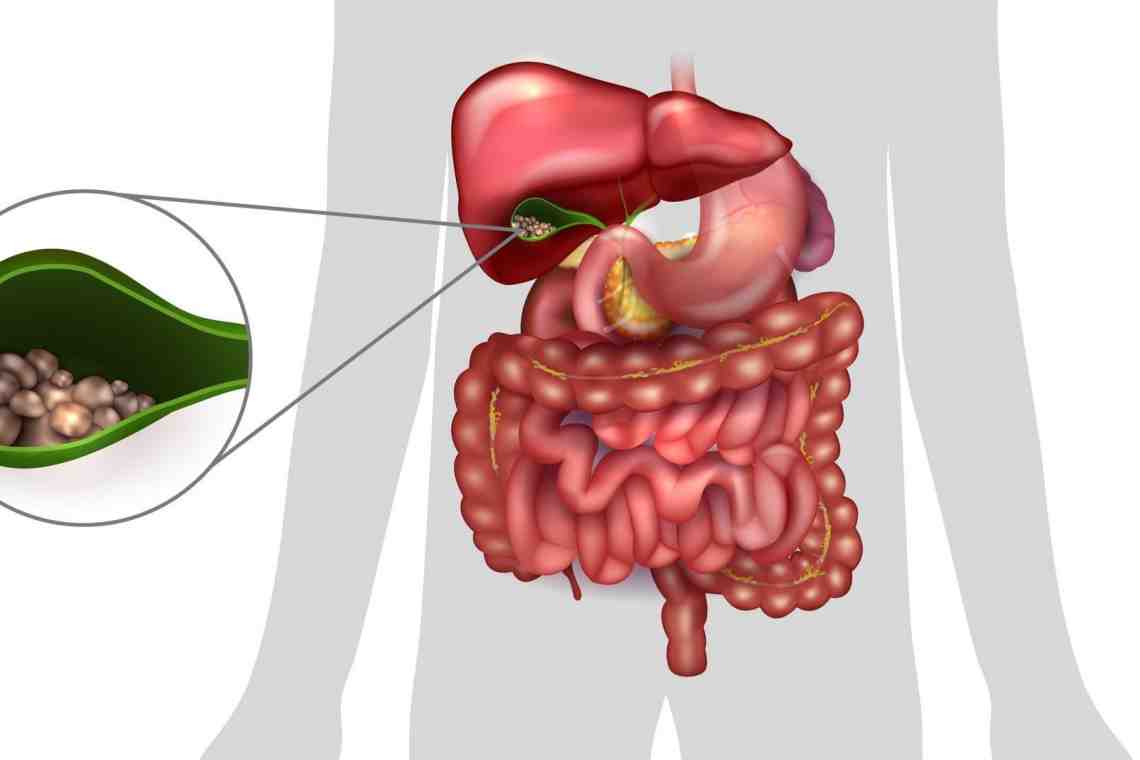 Причины и симптомы желчекаменной болезни