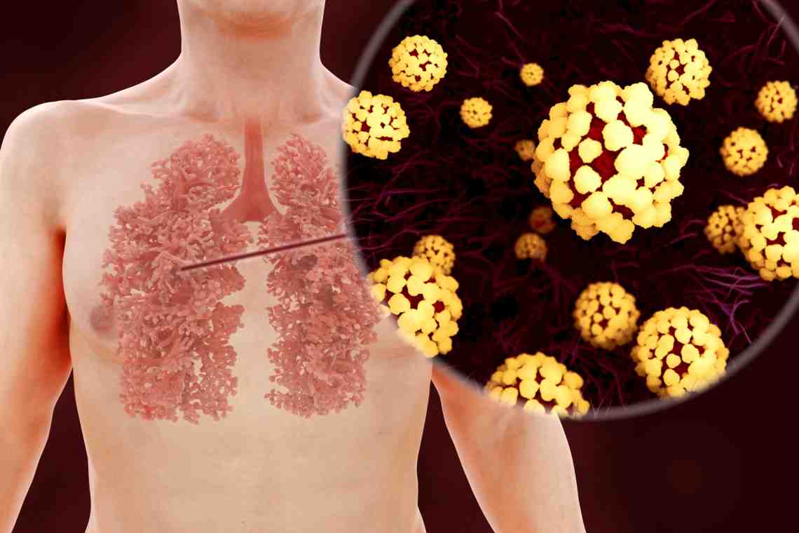 Какие бывают симптомы коронавируса у человека?