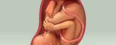 Краевое предлежание плаценты - угроза нормальному течению беременности