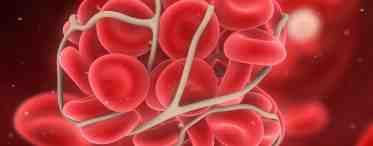 Сгущение крови: причины, симптомы и способы лечения