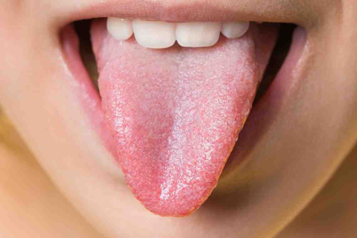 Болит язык: основные причины и методы лечения