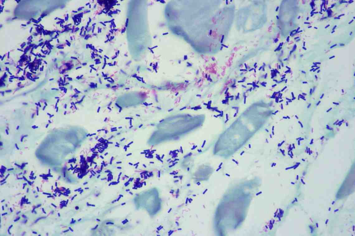 Escherichia coli в мазке: насколько это серьёзно?