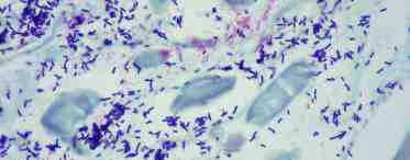 Escherichia coli в мазке: насколько это серьёзно?