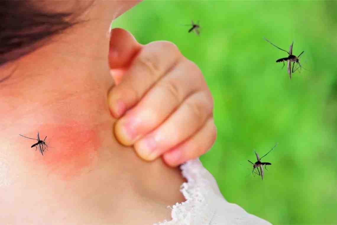 Как облегчить комариные укусы у детей?