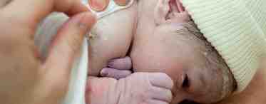 Как проявляется молочница у грудных детей?
