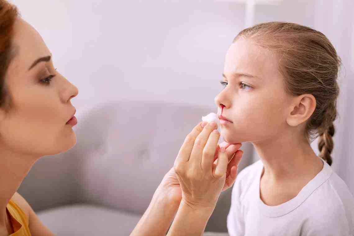 Носовое кровотечение у ребенка: причины и методы борьбы
