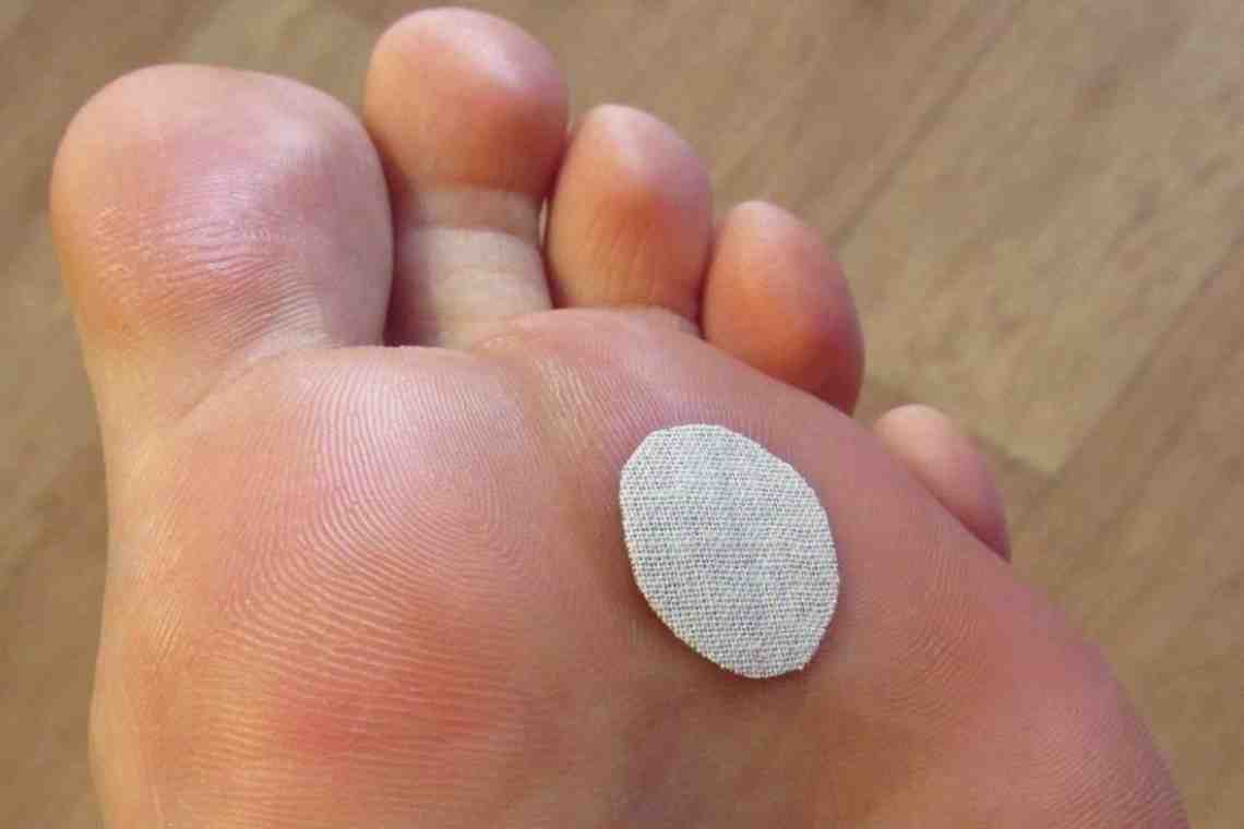 Шипица на пальце: причины появления, лечение медикаментами и народными средствами
