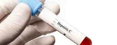 Диагноз: гепатит С. Сколько можно прожить инфицированному человеку?