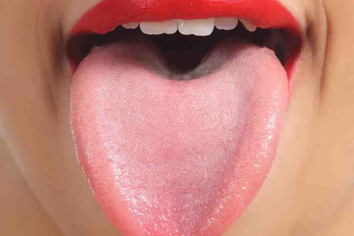 Белый налет на языке у взрослых: причины и лечение