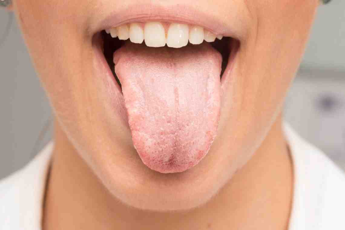 Что делать, если болит язык сбоку? Насколько это опасно?