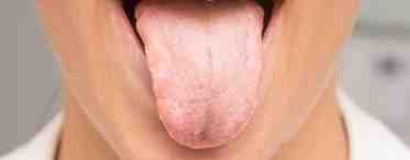 Что делать, если болит язык сбоку? Насколько это опасно?