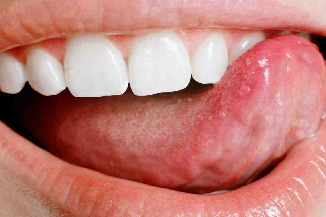 Болит кончик языка. Причины патологии