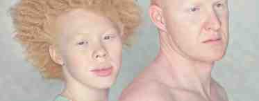 Люди-альбиносы: неужели их стоит бояться?