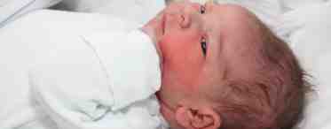 Стафилококк у новорожденных: причины появления и лечение