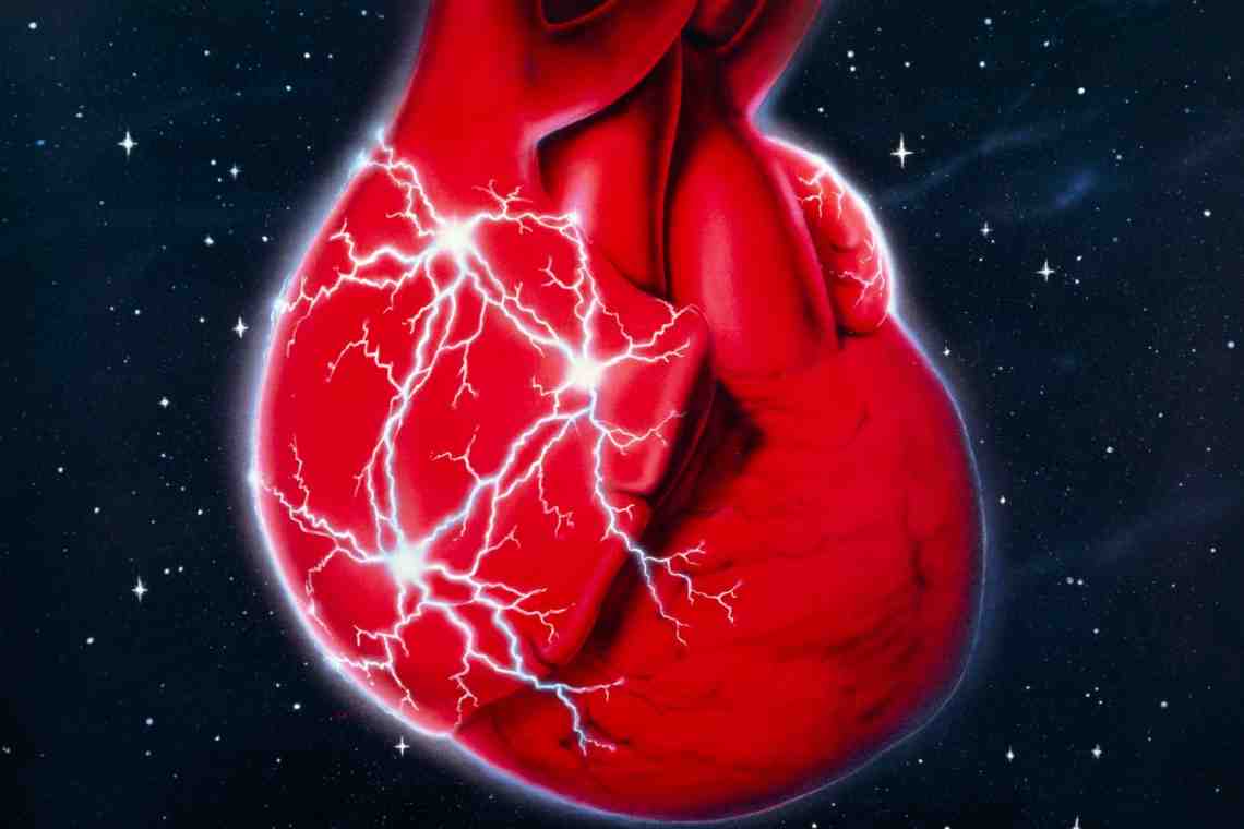Ревматизм сердца: симптомы и лечение