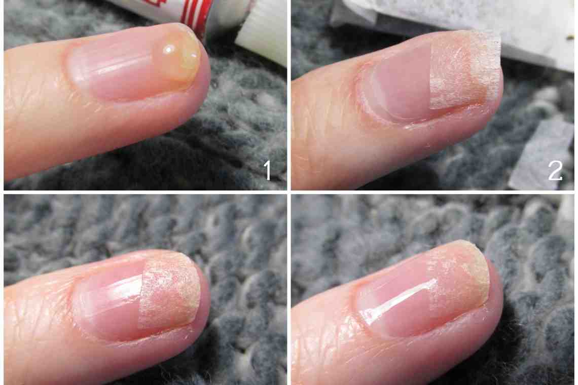 Запечатывание ногтей в домашних условиях – быстрый восстанавливающий маникюр