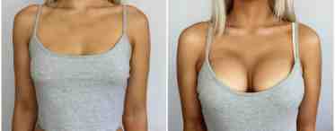 Как должна выглядеть идеальная грудь?