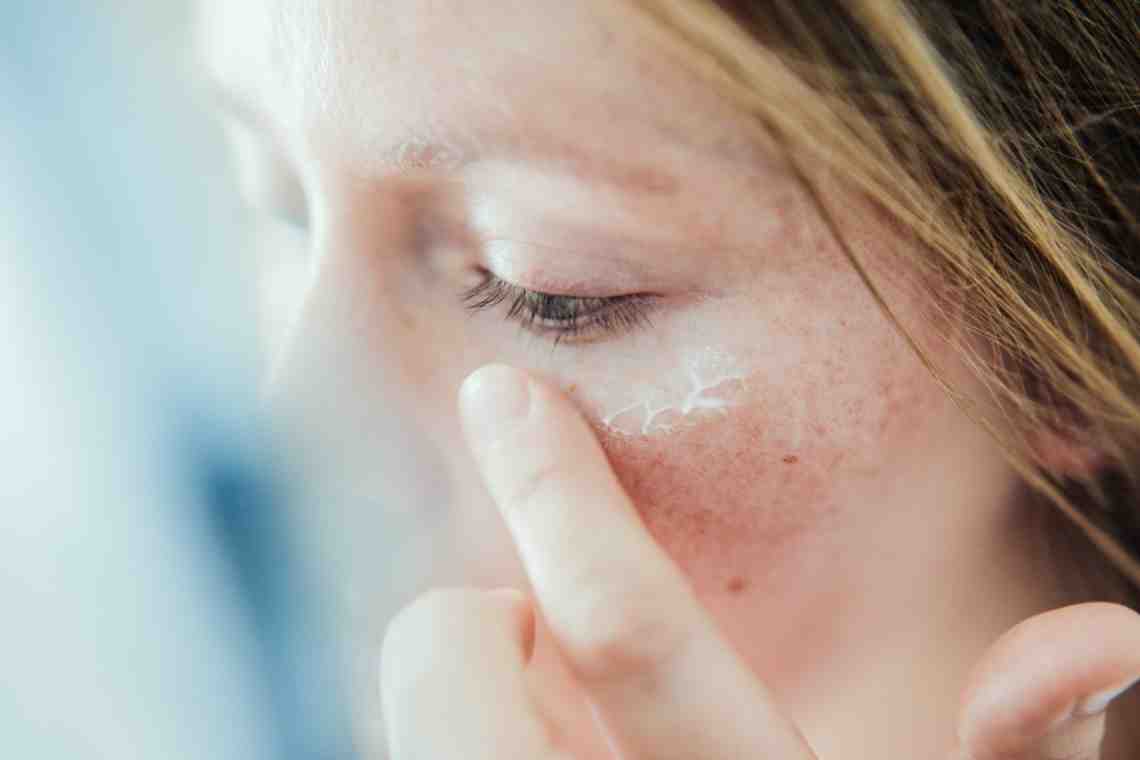 Как избавиться от шелушения кожи?