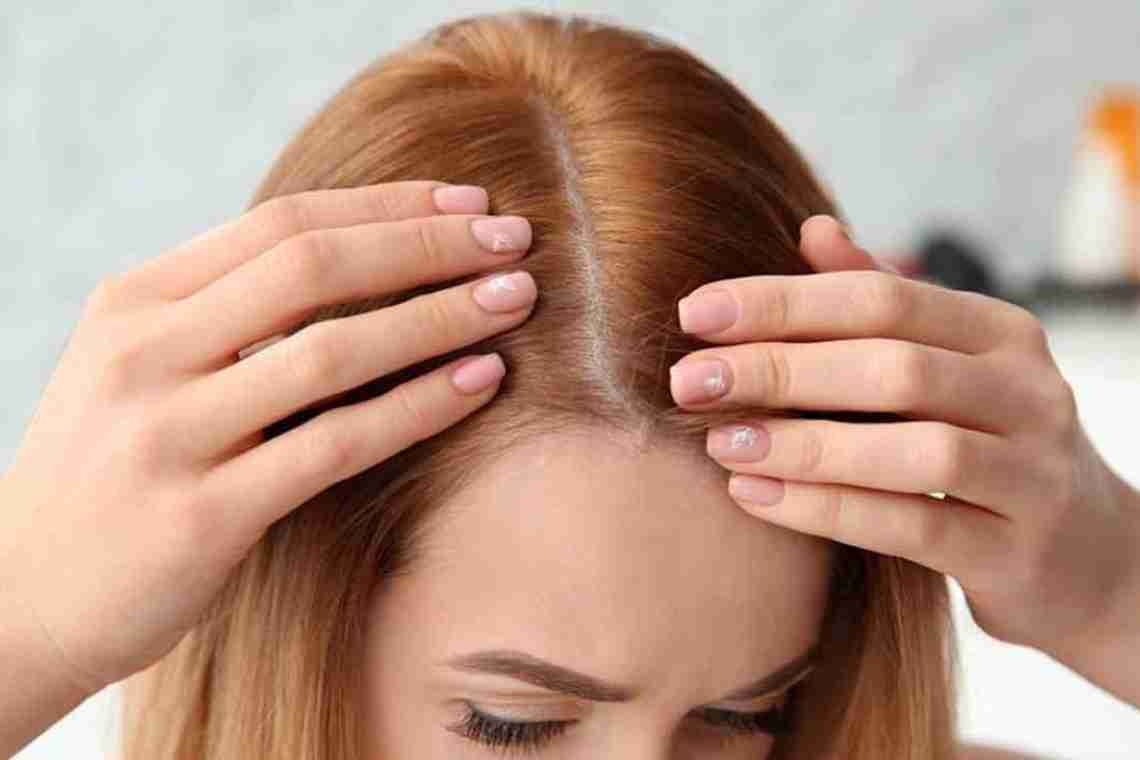Способы устранения причин выпадения волос