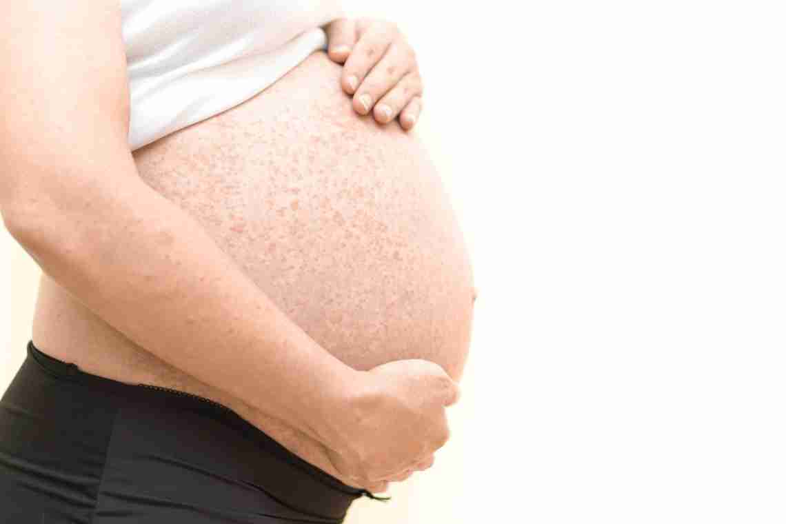 Как лечить аллергию при беременности