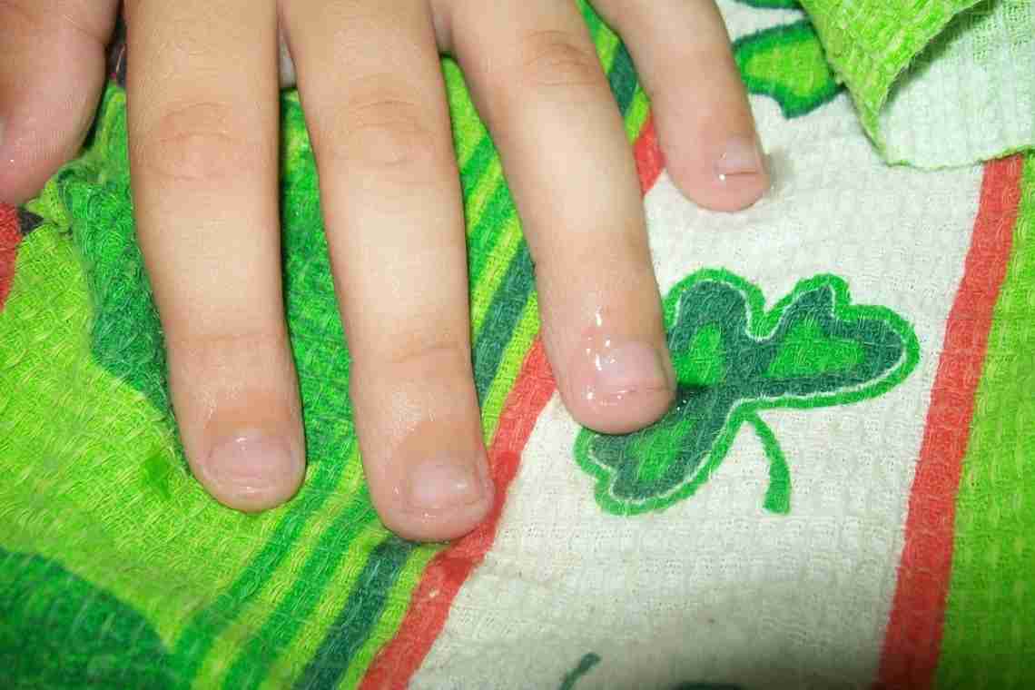 Как отучить грызть ногти