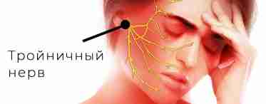 Невропатия лицевого нерва: клиническая картина заболевания