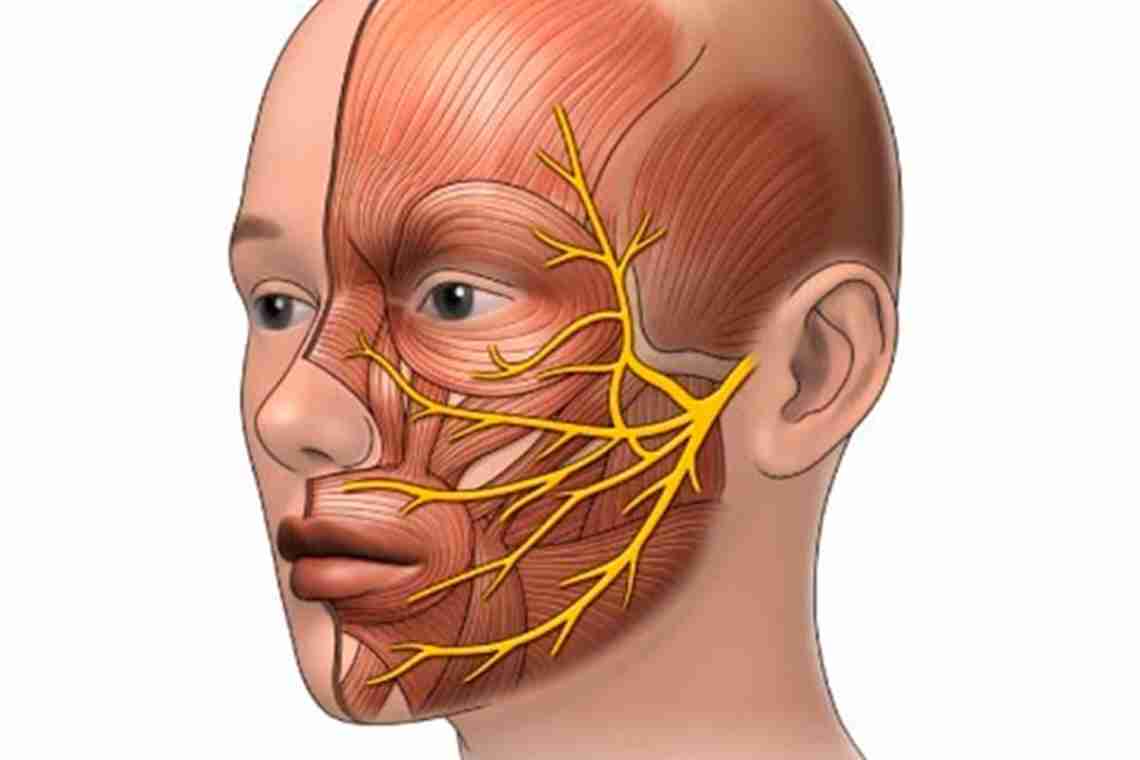 Методы лечения неврита лицевого нерва