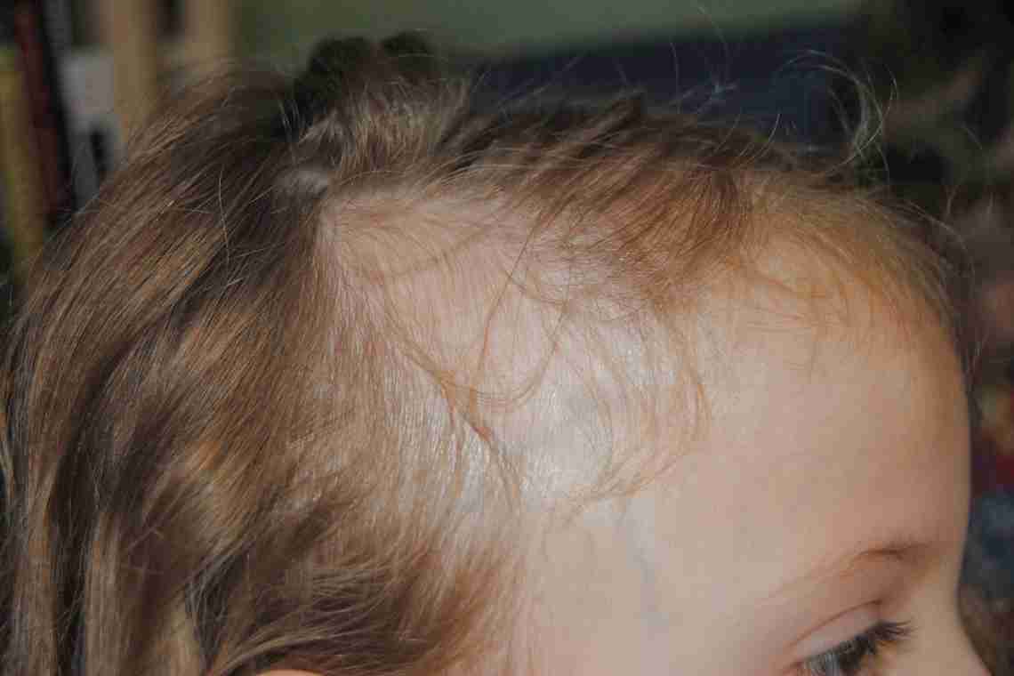 Почему плохо растут волосы у ребенка и как решать эту проблему?