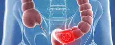 Пневматоз кишечника: причины, симптомы и лечение