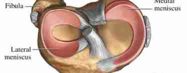 Травматология. Повреждения мениска коленного сустава