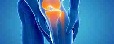 Артроз коленного сустава: лечение и симптомы