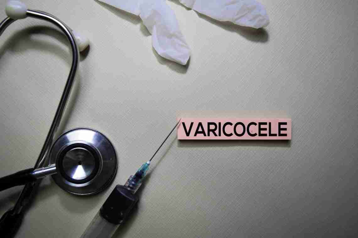 Правда о варикоцеле: лечение без операции