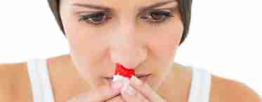 Течет кровь из носа, что делать? Причины и способы решения проблемы