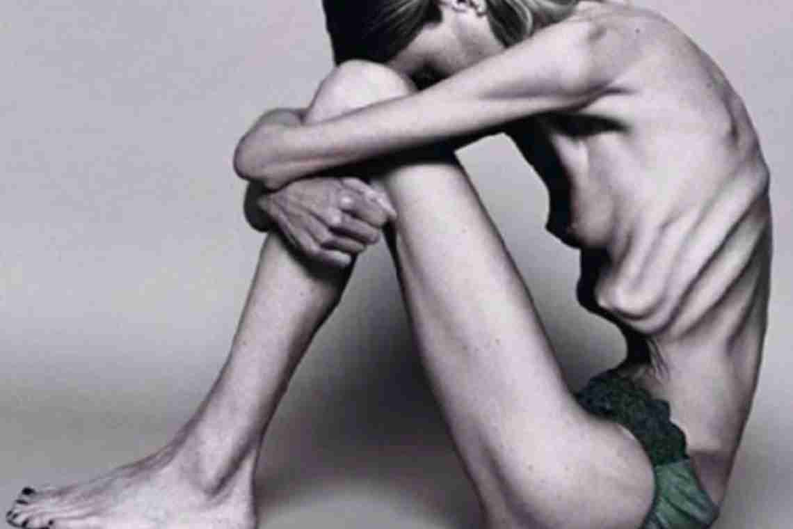 Что такое анорексия и как от нее избавиться