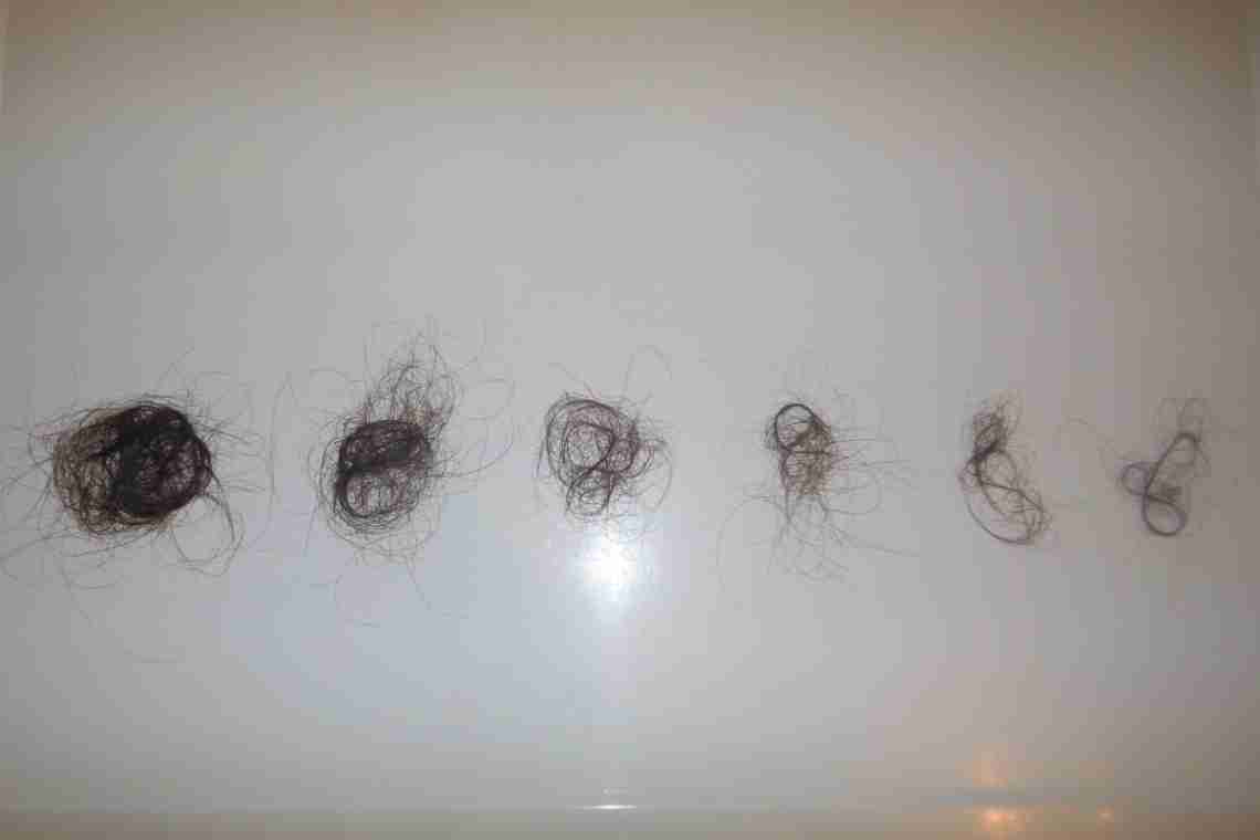 Норма выпадения волос. Норма выпаданий волос в день. Норма выпадения волос у женщин. Норм норма выпадения волос.