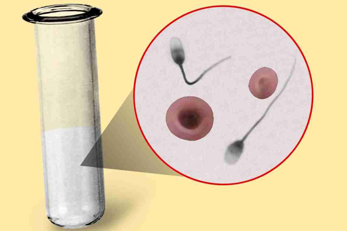 Кровь в сперме у мужчин: причины, лечение